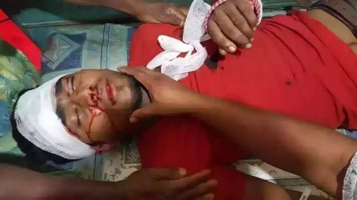 abrar_web's tweet photo. Young Blood on the Roads of Dhaka, #Bangladesh
#WeWantJustice #RoadSafetyBD 
https://t.co/N2u5i6pzKD

@jayathmadw @UNYouthEnvoy https://t.co/zlPlrcuAZA
