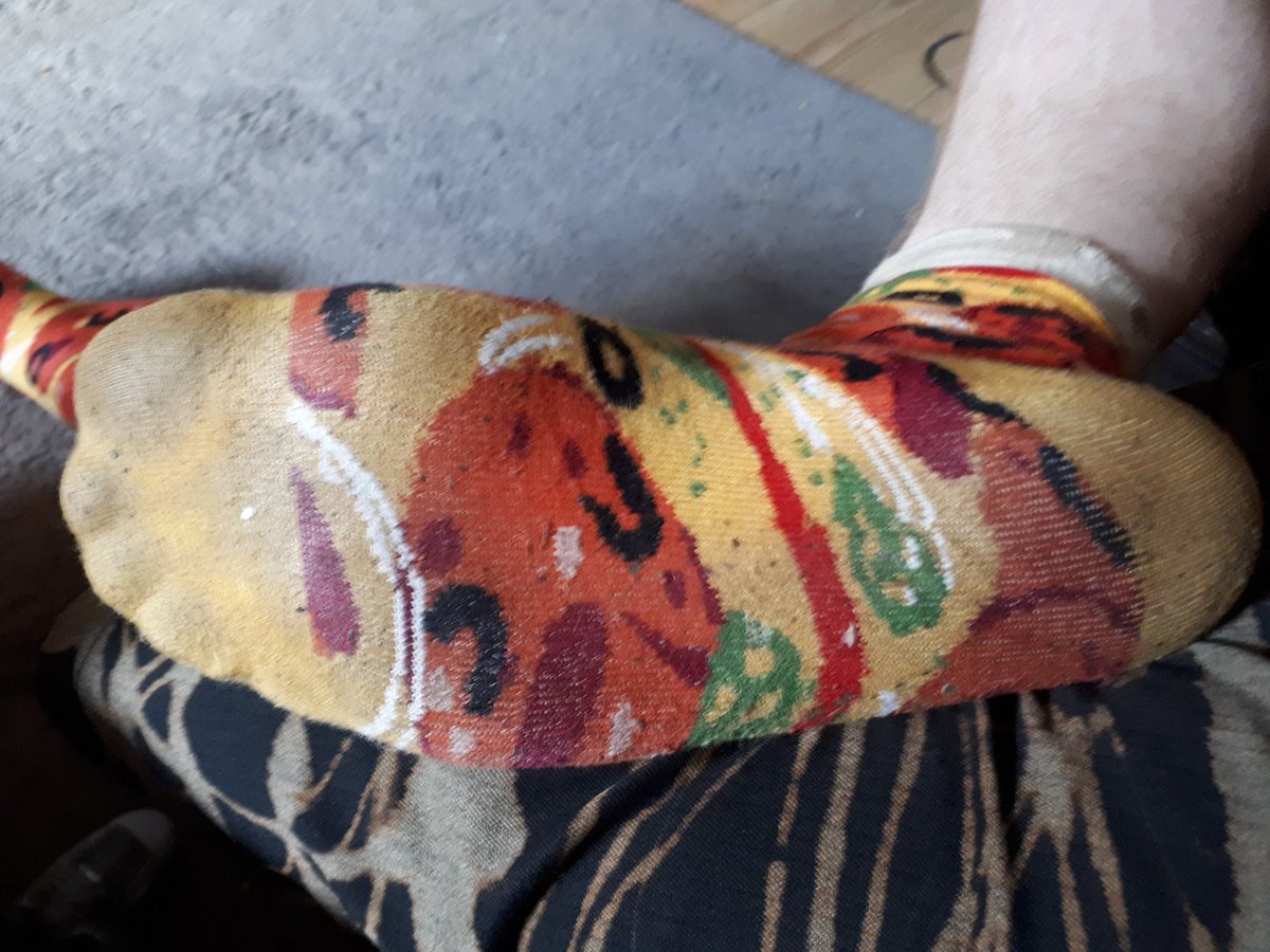 BogPrinceHoggle's tweet photo. Day 4 on these bad boys. Anyone wanna sniff? DM for enquiries. #sweatysocks #dirtysocks #smellysocks #sockfetish #dirtysockfetish #smellysockfetish #isellsocks #socksforsale #mansocks #sockworship #footworship #findom @rtfindom @RTfaggot @RTP1G @rt_feet https://t.co/GVFGwyJjHd