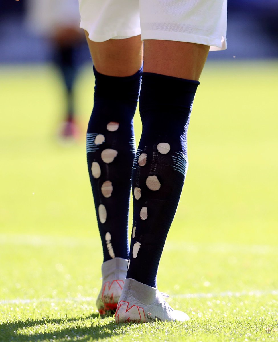 KitCrimes's tweet photo. Anyone want to explain Kyle Walker's socks to me? #MCFC #CommunityShield https://t.co/AEOuQt0RxE
