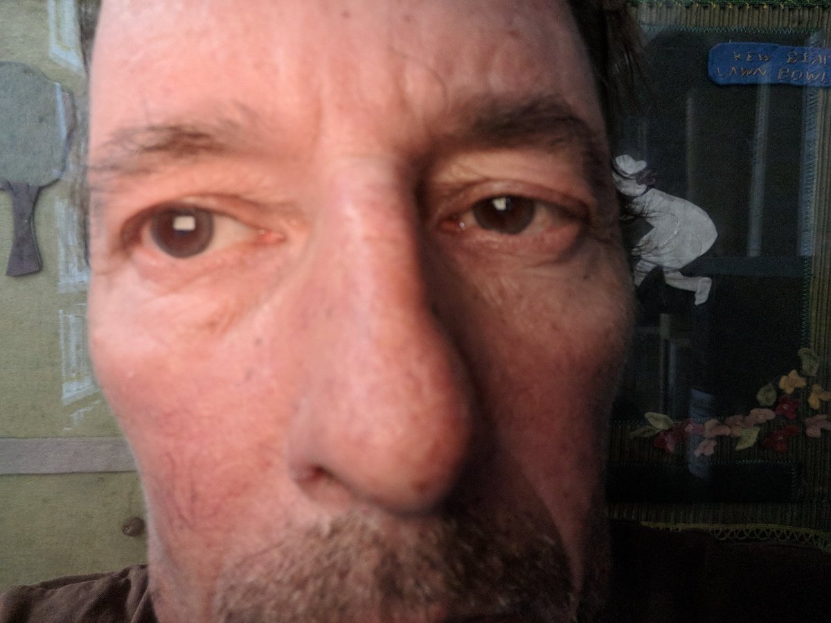 sheriran95's tweet photo. All eyes tell the #Truth we are focused on the continuing #Genocide brought on by #AssadWarCriminal #PutinWarCriminal & #Halesh
#EyesOnIdlib is our duty for
#OppressedSyrians #TrappedInSyria
Let's do our best to #SaveTheRest
#EndAssad bashar must go! ๐๐๐ค๐ฃ https://t.co/yAUQbKrwqC