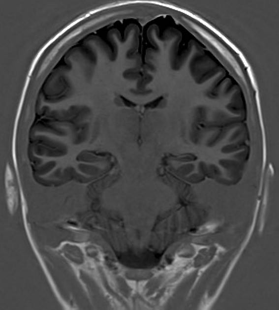 RadiologySigns's tweet photo. Q: What clinical condition is this patient likely to suffer from?
ANSWER: https://t.co/0CYRCRa5lW #FOAMrad #FOAMed https://t.co/gw1bPj6a0H