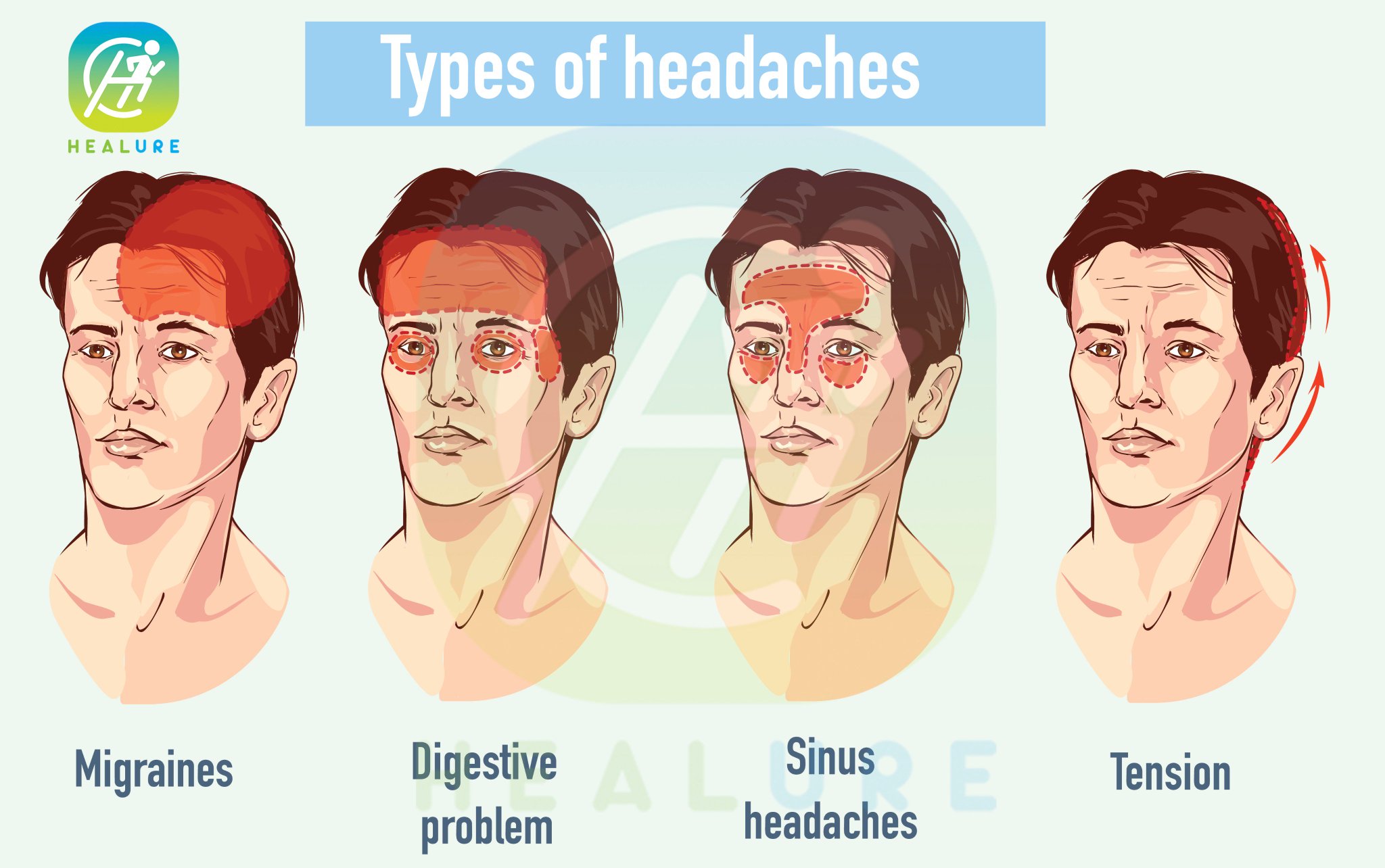 “Types of Headaches
#headache #migraine #sinus #tension #digestivep...
