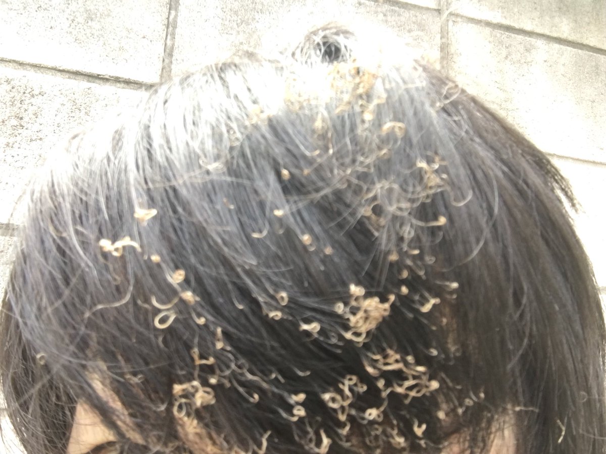 Kentaro 前髪めっちゃ焦げたww Kentaro 前髪めっちゃ焦げたww
