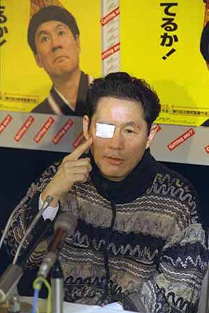 1995年のビートたけし Twitter Search