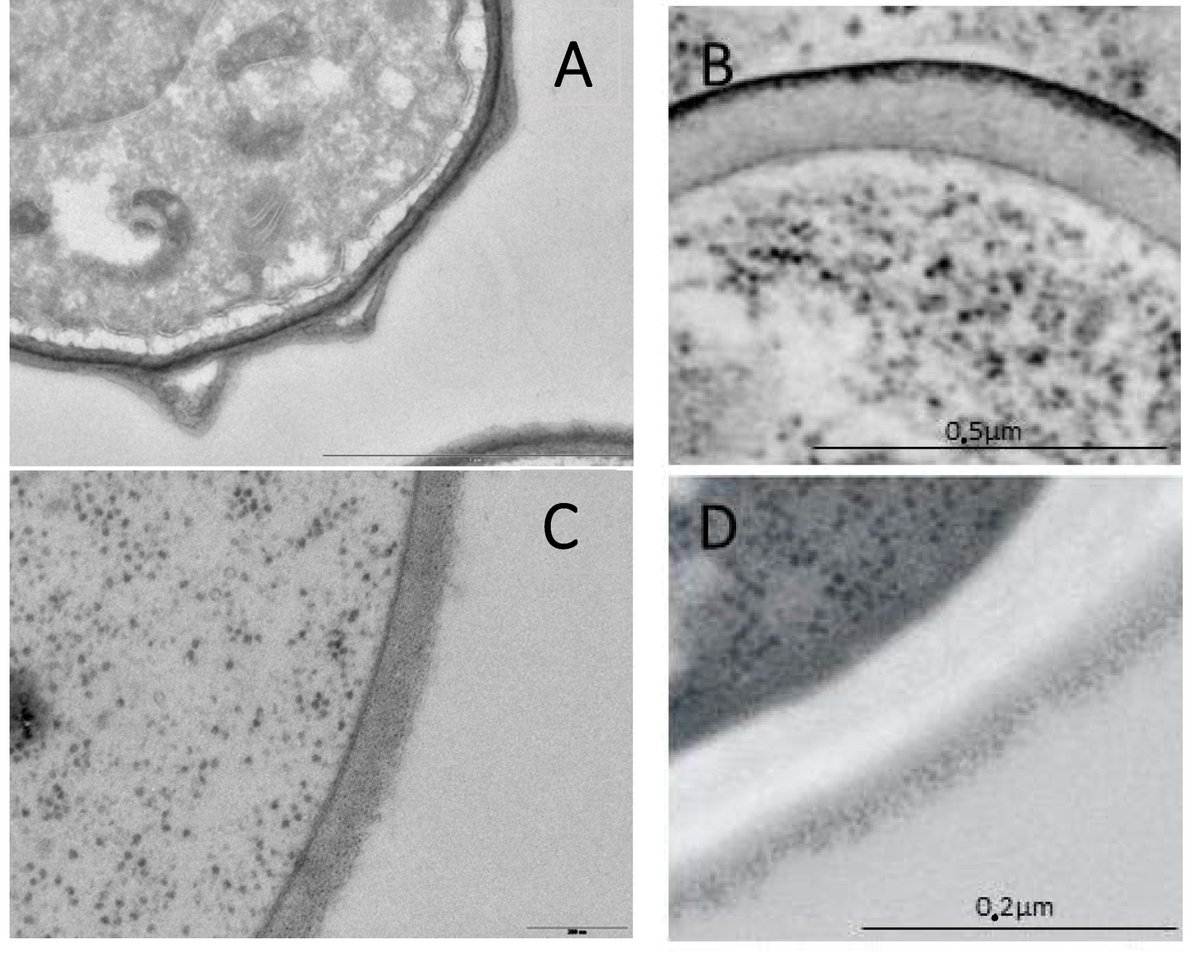 JoF_MDPI's tweet image. Drs. Anne Beauvais and Jean-Paul Latgé prepared an Editorial for JoF special issue &quot;Fungal Cell Wall: J. Fungi 2018, 4(3), 91; doi.org/10.3390/jof403…  #cellwall #fungalcellwall