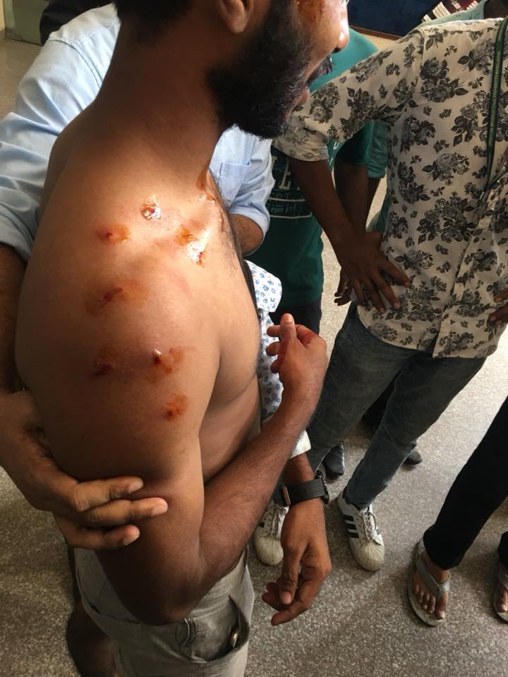 tahsin_jeba's tweet photo. all of these are photoshoots right ? none of it are real right dear government ? we r just playing "chor police" no? shame on u bangladesh!

#RoadSafetyMovement #WeWantJustice #BangladeshStudentProtests @BBCWorld @BBCBreaking @CNN @cnnbrk @AlJazeera @UNICEF @UN https://t.co/htUljC85zf