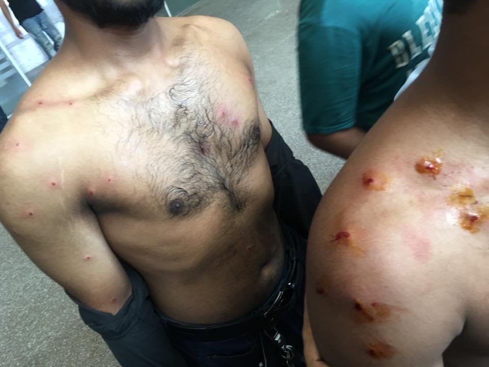 tahsin_jeba's tweet photo. all of these are photoshoots right ? none of it are real right dear government ? we r just playing "chor police" no? shame on u bangladesh!

#RoadSafetyMovement #WeWantJustice #BangladeshStudentProtests @BBCWorld @BBCBreaking @CNN @cnnbrk @AlJazeera @UNICEF @UN https://t.co/htUljC85zf