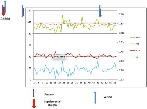 CRMjournal's tweet photo. Recently accepted: Inadequacy Of #PulseOximetry in the #CatheterizationLaboratory. An #ExploratoryStudy Monitoring #Respiratory Status Using #ArterialBloodGases During #CardiacCatheterization With #ConsciousSedation by @ZaherFanari et al. https://t.co/5vFLcuEtM9 https://t.co/NxV4YWq8ZY