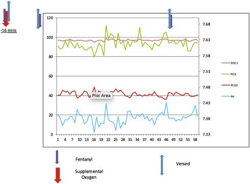 Recently accepted: Inadequacy Of #PulseOximetry in the #CatheterizationLaboratory. An #ExploratoryStudy Monitoring #Respiratory Status Using #ArterialBloodGases During #CardiacCatheterization With #ConsciousSedation by @ZaherFanari et al. bit.ly/2OfNzh7