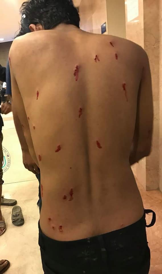 tahsin_jeba's tweet photo. okay so these are blood are fake too !?

how much more bangladesh....!? I feel ashamed of our country 😢

#RoadSafetyMovement #WeWantJustice #SaveBangladesh #bangladeshstudentprotests @BBCWorld @BBCBreaking @CNN @cnnbrk @AlJazeera @UNICEF @UN https://t.co/2SYy0MvdgK