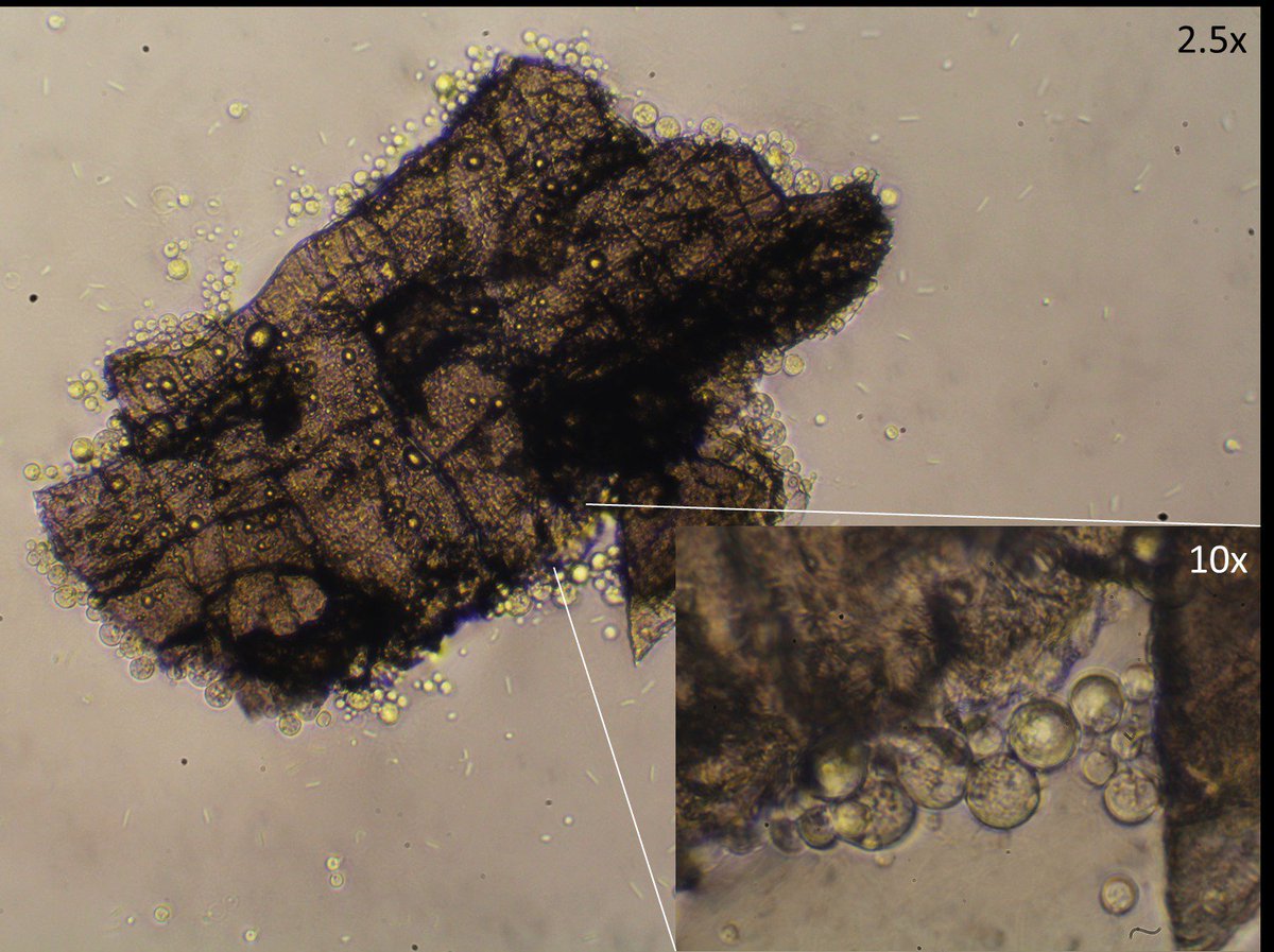 musicalmicrobe's tweet photo. Go fungi, go! These #chytrid #fungi have attached to a food source and now they're on it, they'll digest it from the inside out using the nutrients to make more fungi.
#mycology #microbiology #MResMBio https://t.co/mfdKN535MO