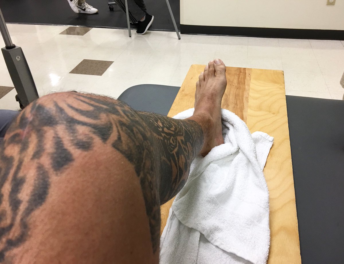 8 weeks out from Patellar Tendon Rupture surgery. Got to 86 degrees of flexion today. Gained 35 degrees in past 10 days.
 51 ➡️ 86