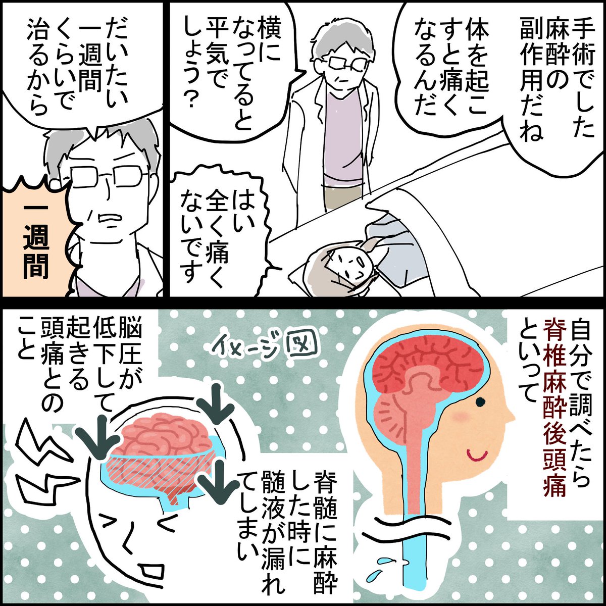 続き。
手塚治虫風にしたのがとても分かりにくい。
痛みとめまいと吐き気で、体験した事のない頭痛でした。髄液が復活して治るのを待つしかないとのこと。 