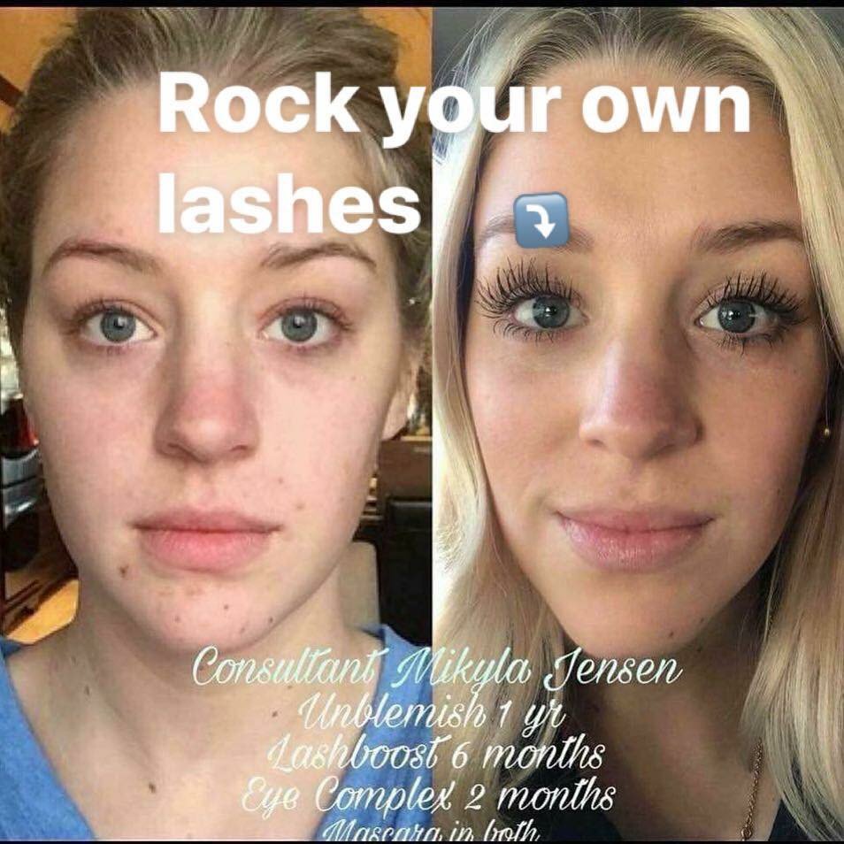 tbarrettx5's tweet photo. Who wants to rock their lashes this summer and have longer, fuller, thicker looking lashes??

All it takes is one quick swipe at night <10secs/night.  Message me for details. https://t.co/6NWZkrVIx6