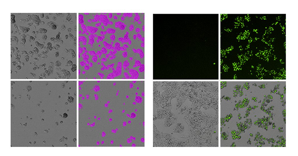 moldev's tweet photo. Check out our blog post on the use of HepG2 cells in the study of liver disease https://t.co/ZNWy21173m   
#LiverResearch #HepG2Cells #HepatitisDay https://t.co/APQbiTgAgJ