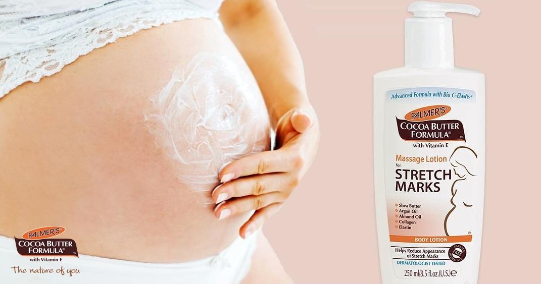 Agree that Our Massage Lotion for Stretch Marks is a Mom must have? Double tap if you agree! #palmersbelly #cocoabutter #whattoexpect #massagelotion #palmersidn