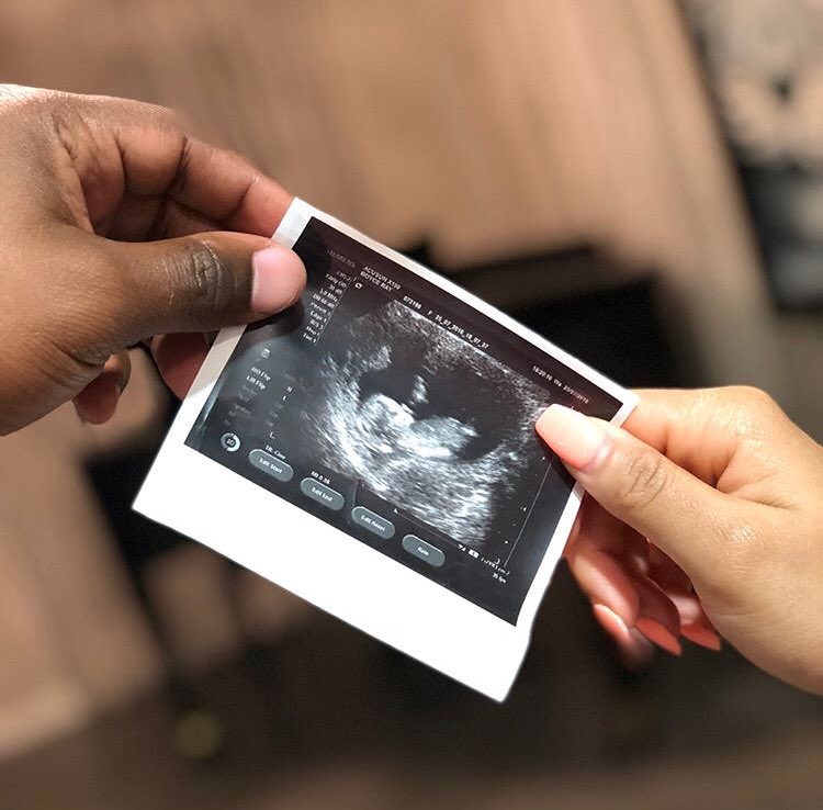 MoChunksTV's tweet photo. Congratulations to yelebrity, @ItsMyRayeRaye and her hubby, Eric!
Theyβre having a baby πΆπ½β€οΈβ€οΈβ€οΈ
#BabyBloom #Itsmyrayeraye #Trending https://t.co/QQZ8jvNx4p