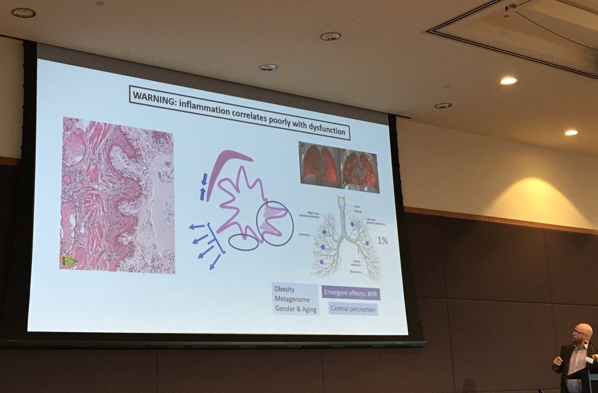 COsadnik's tweet photo. Lung ‘emergence’: problems in as little as <1% of small airways enough to trigger whole lung dysfunction in asthma! G. Anderson #SOTA18 https://t.co/K9ukoMbiCf