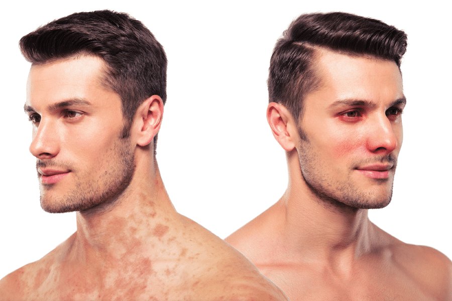 Do you need some quality CPD time? Then you need Dermatology Academy! Treat yourself this weekend by registering for our August event. education.australiandoctor.com.au