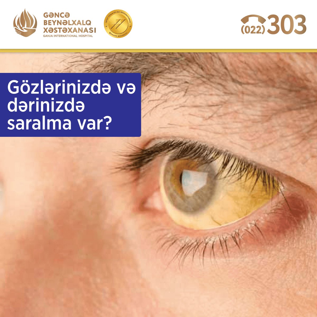 Gözlərinizdə və dərinizdə saralma var? Hərarətiniz bir neçə gün düşmür?
Bu sahədə çalışan Qastroentroloq, Hepatoloq Dr. Müslüm Nursoy sizə yardımçı ola bilər.

gbx.az #gih #gbx #ganjainternationalhospital #hepatitB #hepatitC #sirroz #müalicə #hepatoloq