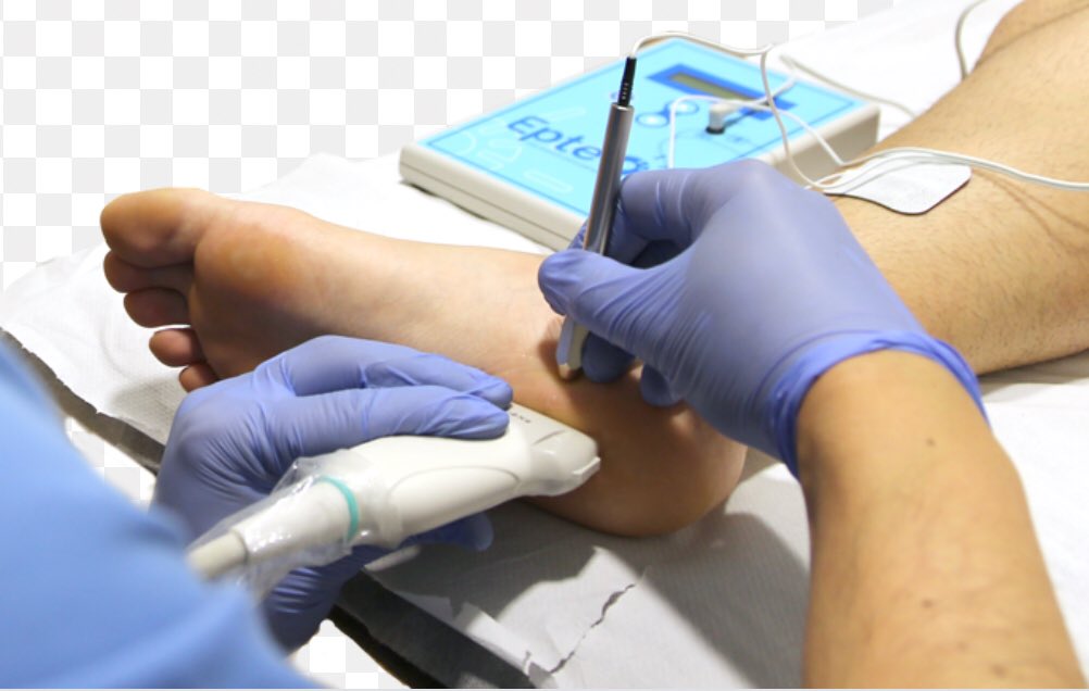 cursofisiodep's tweet image. Hoy os presentamos ntro último módulo: EPTE® ecoguiado. Ntro  prestigioso docente Sebastián Truyoñs abordará esta interesante técnica invasiva. Se abordará patología deportiva sobre tendón, músculo... El último módulo! La guinda del pastel d esta innovadora formación en Zaragoza.