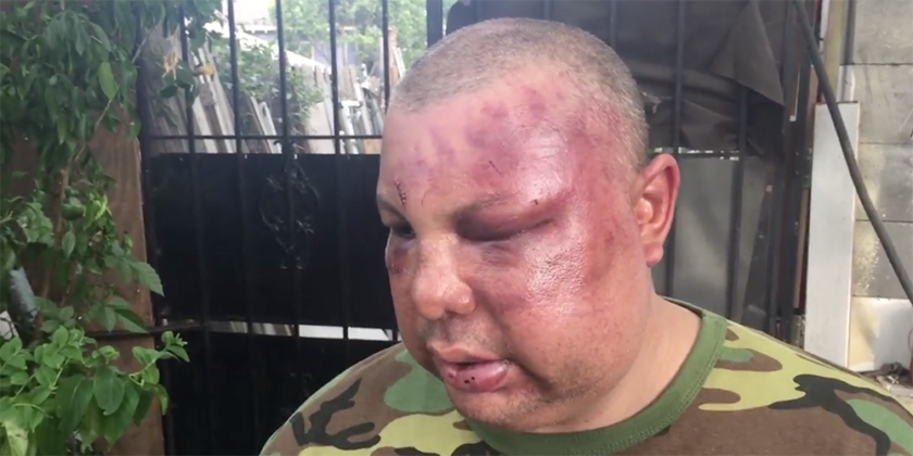 thinkprogress's tweet photo. Two New Orleans cops arrested, fired after beating bar patron and questioning his nationality https://t.co/tuQo3udPIp https://t.co/235xgZbKdd