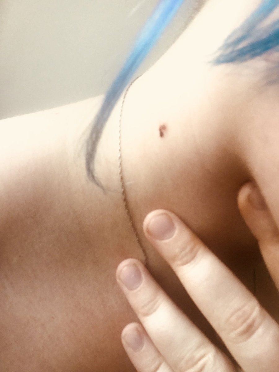 g4merslu7's tweet photo. As if the weather isn’t bad enough, something bit me on my way into work this morning...god knows what but I got the bugger! #BugsSuck #Ouch #FurnaceFriday https://t.co/d0UgADFjJ6