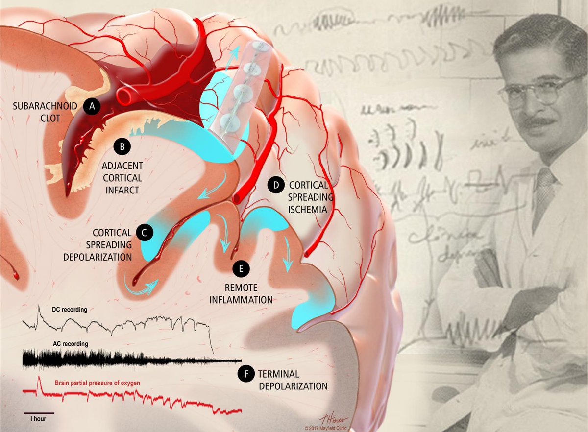 COSBID's tweet image. Did you know that #spreadingdepolarizations were first described in 1944 by Brazilian physiologist Aristides Leão? 
charite-academy.de/a-brief-histor…