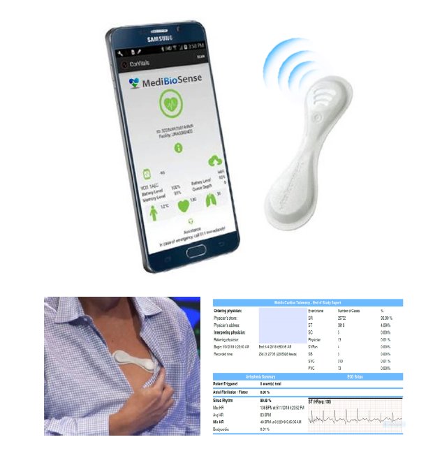 MediBioSense (@medibiosense) on Twitter photo <a href="/MediBioSense/">MediBioSense</a> introduces MCT (Mobile Cardiac Telemetry). Replacing the holter with a unobtrusive wearable patch, no more waiting weeks for ECG results, cardiac events are monitored/responded in realtime and full analytics at the end of the patient monitoring period #digitalhealth <a href="/MediBioSense/">MediBioSense</a> introduces MCT (Mobile Cardiac Telemetry). Replacing the holter with a unobtrusive wearable patch, no more waiting weeks for ECG results, cardiac events are monitored/responded in realtime and full analytics at the end of the patient monitoring period #digitalhealth