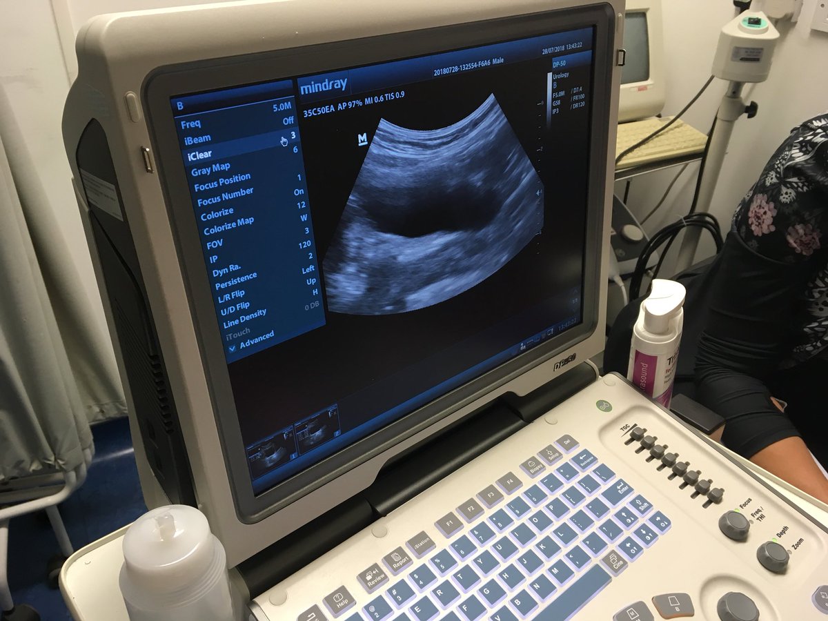 lindajdeacon's tweet photo. #PUMUS A lovely ultrasound scan of a lovely bladder! #mindray @AbsolutePhysio https://t.co/1KUhVZGBvC