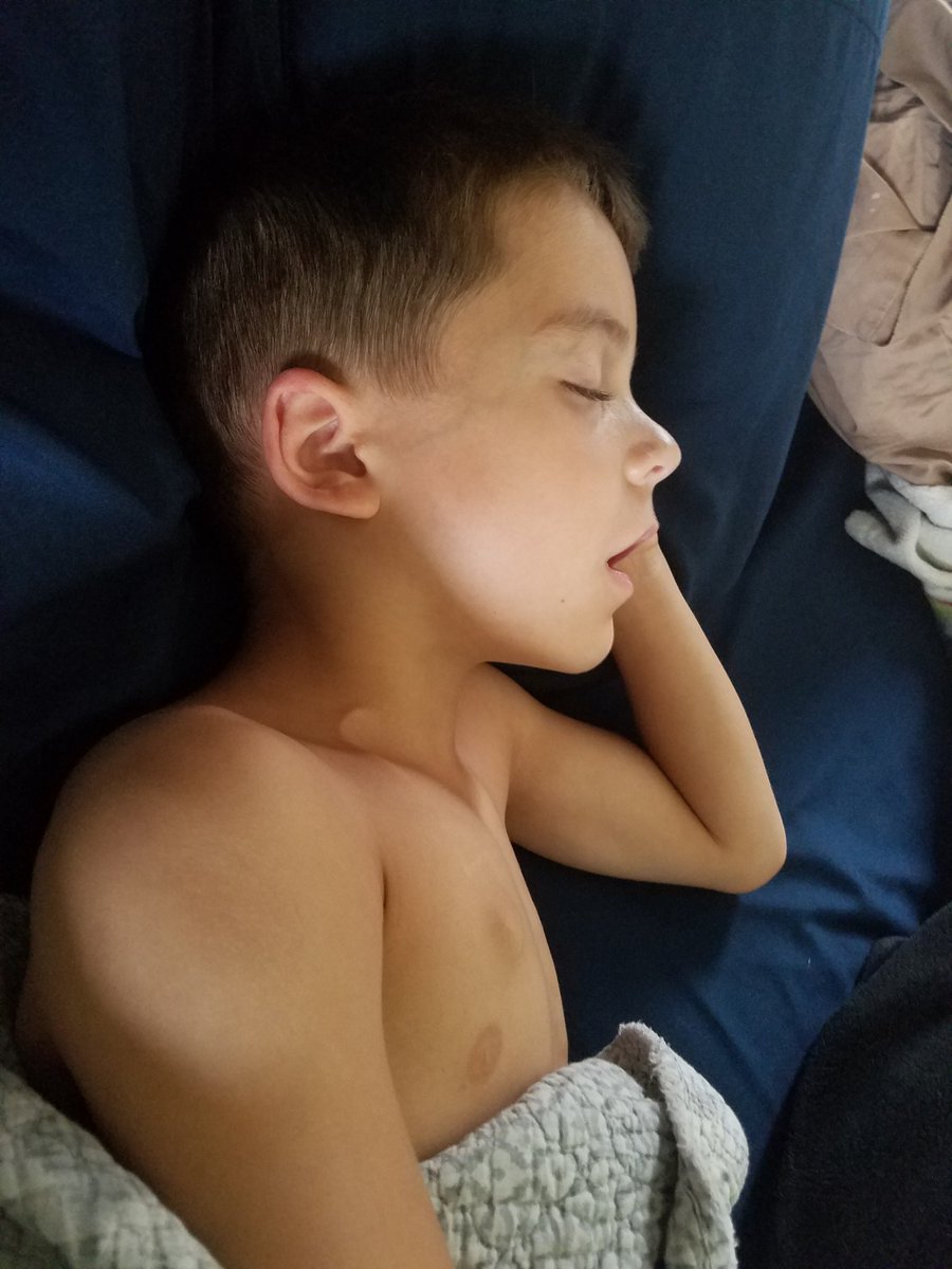SmashLeukemia's tweet photo. And another day of fever. 100.3 this morning, close to the 100.4 that would require an ER trip. Only good thing, he can relax and watch wrestling all day thanks to @trackwrestling
#SmashLeukemia
#FeverWatch https://t.co/EK09JxuRss