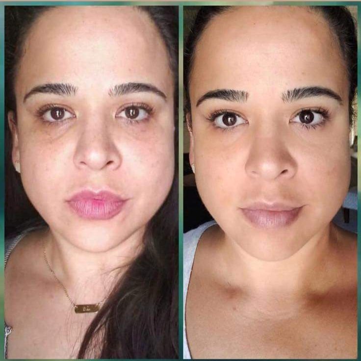 NikkiRhodes07's tweet photo. Loving this new #skincare and the #Results just keep coming in!!! #obsesh https://t.co/A0yrDSeHtk