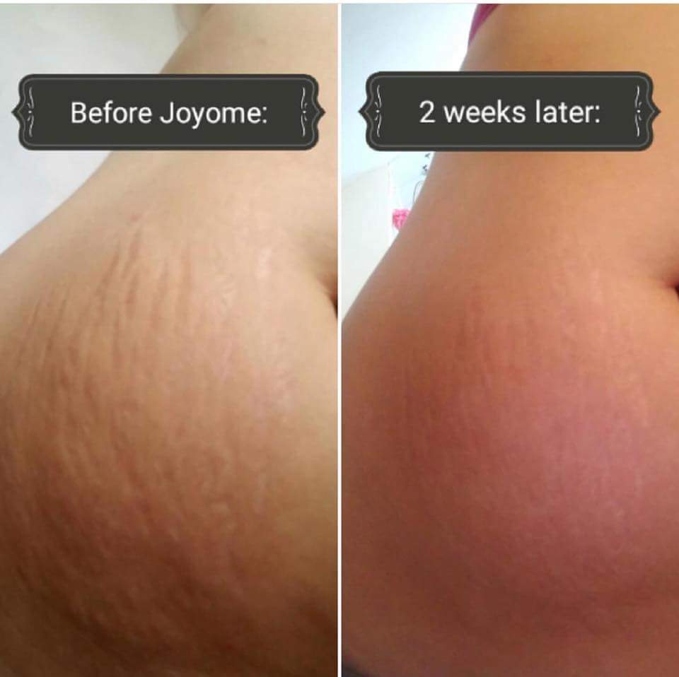NikkiRhodes07's tweet photo. Loving this new #skincare and the #Results just keep coming in!!! #obsesh https://t.co/A0yrDSeHtk