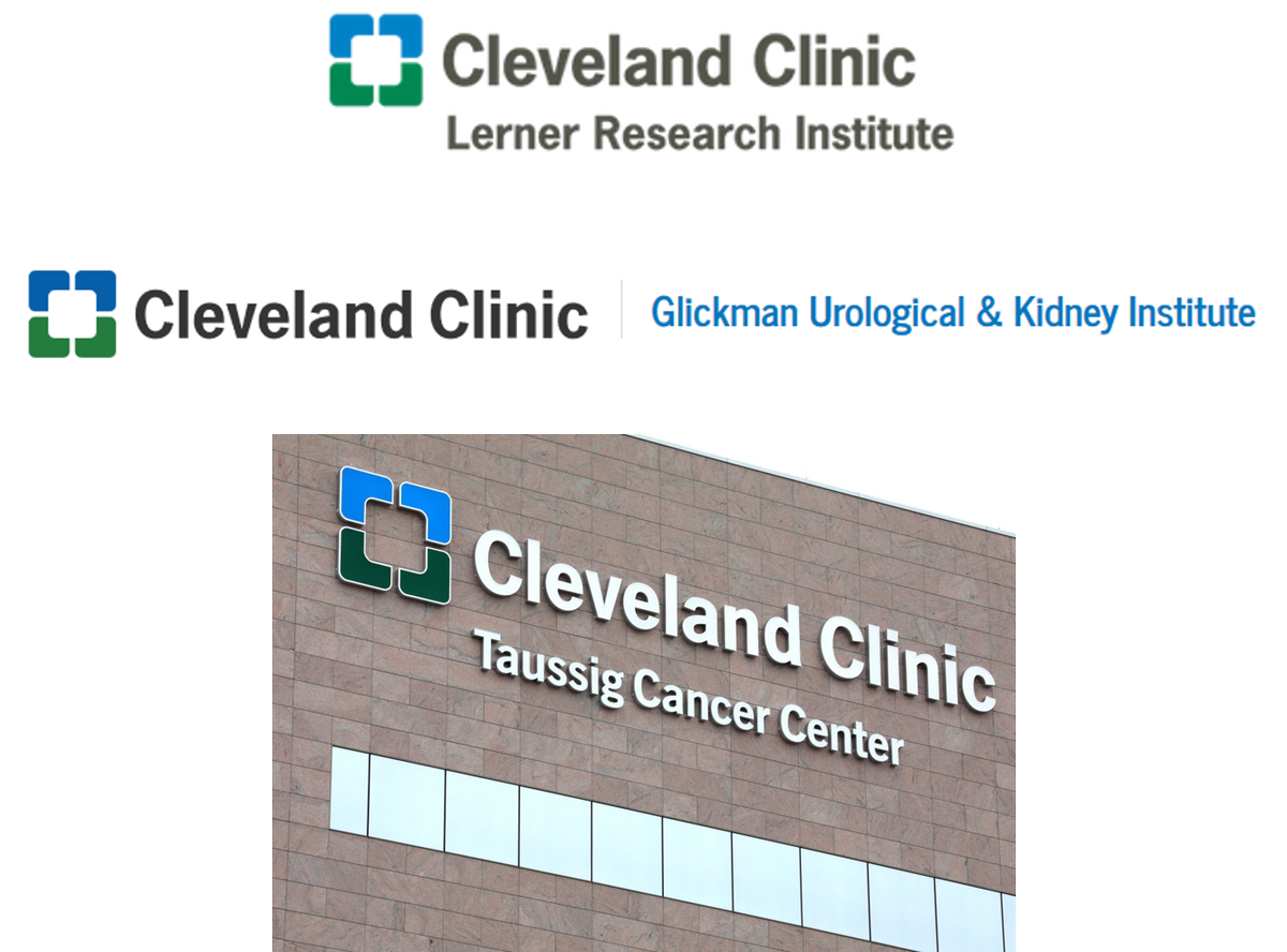 Eric Klein (@erickleinmd) on Twitter photo Excited to announce our newly formed multi-D GU Malignancy Research Ctr headed by <a href="/NimaSharifiMD/">Nima Sharifi</a>. Seeking outstanding PhD&MD scientists to expand our efforts in prostate, kidney and bladder cancer. Details at bit.ly/2NTMxqH. <a href="/CleClinicUro/">Cleveland Clinic Urology</a> <a href="/CCLRI/">Cleveland Clinic Lerner Research Institute</a> #CleClinicCancer Excited to announce our newly formed multi-D GU Malignancy Research Ctr headed by <a href="/NimaSharifiMD/">Nima Sharifi</a>. Seeking outstanding PhD&MD scientists to expand our efforts in prostate, kidney and bladder cancer. Details at bit.ly/2NTMxqH. <a href="/CleClinicUro/">Cleveland Clinic Urology</a> <a href="/CCLRI/">Cleveland Clinic Lerner Research Institute</a> #CleClinicCancer