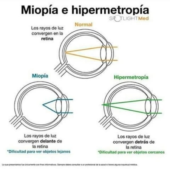 CorpRyemed's tweet photo. Si eres oftalmólogo u optometrista ¡Deberías saber esto!
#Medicina #Ryemed #Venezuela #DIU https://t.co/5rSmaAtxHQ