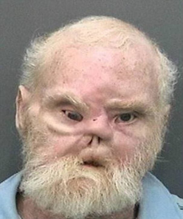 Svona líður mér nákvæmnlega þegar ég fæ bolta í andlitið