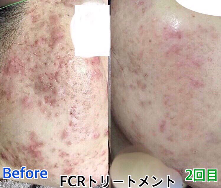Treatment Room Thred 新宿 大阪 Roomthred ট ইট র