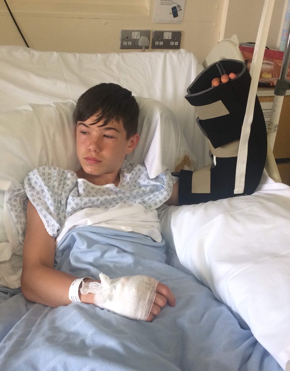 HSYCCoy's tweet photo. As @hsyacf1 #ArmyCadets embark on their Annual Camp, Cadet Cpl Wake from @acfdonanddearne did this 48 hours before he was due to go.  We wish him a speedy recovery and thank his mum for granting permission to share. https://t.co/vX7Fwscvms