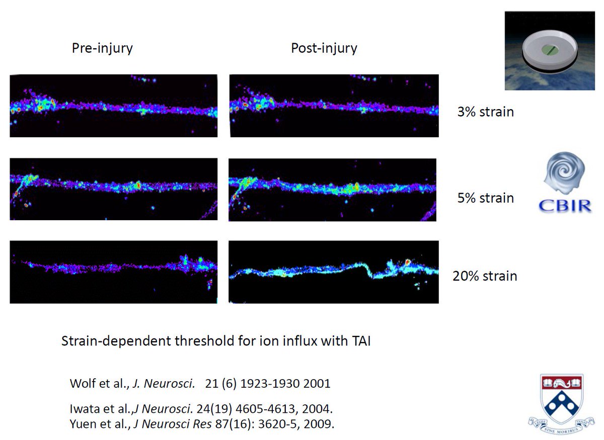 griz1's tweet photo. Traumatic #axonalinjury causes strain-dependent ion influx. #DrDougSmith @PennMedicine @AANMember #Sports #Concussion Conf. #AANSCC @Neurotrauma @NeuroTrauma18 @TheNewANA1 @neuropathology @WillStewNeuro @Penn #DAI #TAI #TBI
https://t.co/RR5PjyOcAQ https://t.co/q6UjTtmIFD