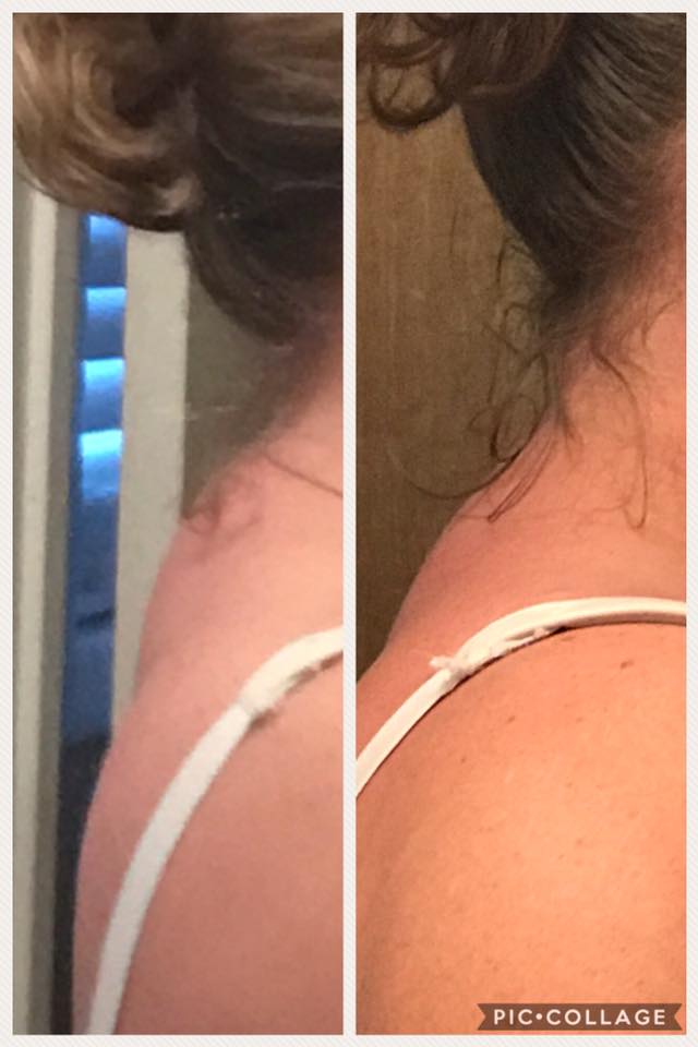 fasciablaster's tweet photo. Try FasciaBlasting the back of your neck! This user did and she's happy she gave it a try! https://t.co/d3k6wCzP7e