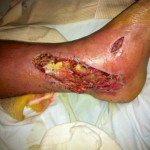 truthsearch1957's tweet photo. Boycott Maryland Poop Palace
Don't Visit or Swim in Annapolis MD Feces
#Annapolis Bay = “Flesh-eating bacteria”
U WILL BE A #BACTERIA #CAFETERIA
Many Vibrio Species
Vibrio vulnificus =
severe skin ulcers
gangrene
deadly blood infections
Jail #NMS15a Analpus $PIGS = Molester Mucks https://t.co/jXAu2wK5Tp