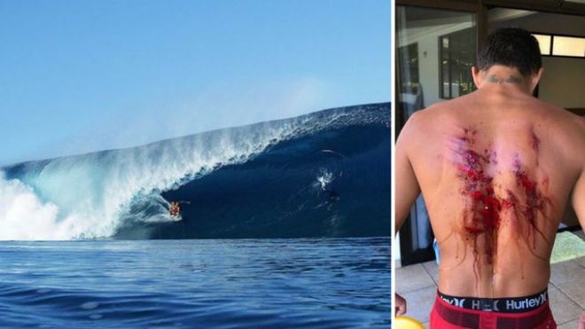 Polynesiela1ere's tweet photo. Le Brésilien, Filipe Toledo est à #Tahiti depuis quelques jours afin de s'entraîner pour la "#Tahiti_Pro 2018". Le surfeur pro s'est rendu sur la vague mythique de #Teahupoo mais la mâchoire ne lui a pas fait de cadeau... https://t.co/ZdzXhH4Uu9 Tahiti Polynesie https://t.co/Lm0R1VCVO1
