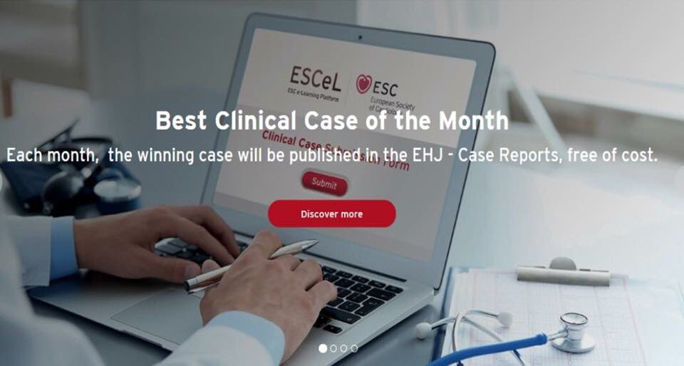 JGrapsa's tweet photo. Please note that ESC clinical case gallery is an ESC education tool that merges all subspecialties - therefore all kind of clinical cases are welcomed!  #cardiology #imaging #cath #congenital #electrophysiology :  https://t.co/gKcthk2Eh5 @escardio @rladeiraslopes https://t.co/kdzWoJT03t