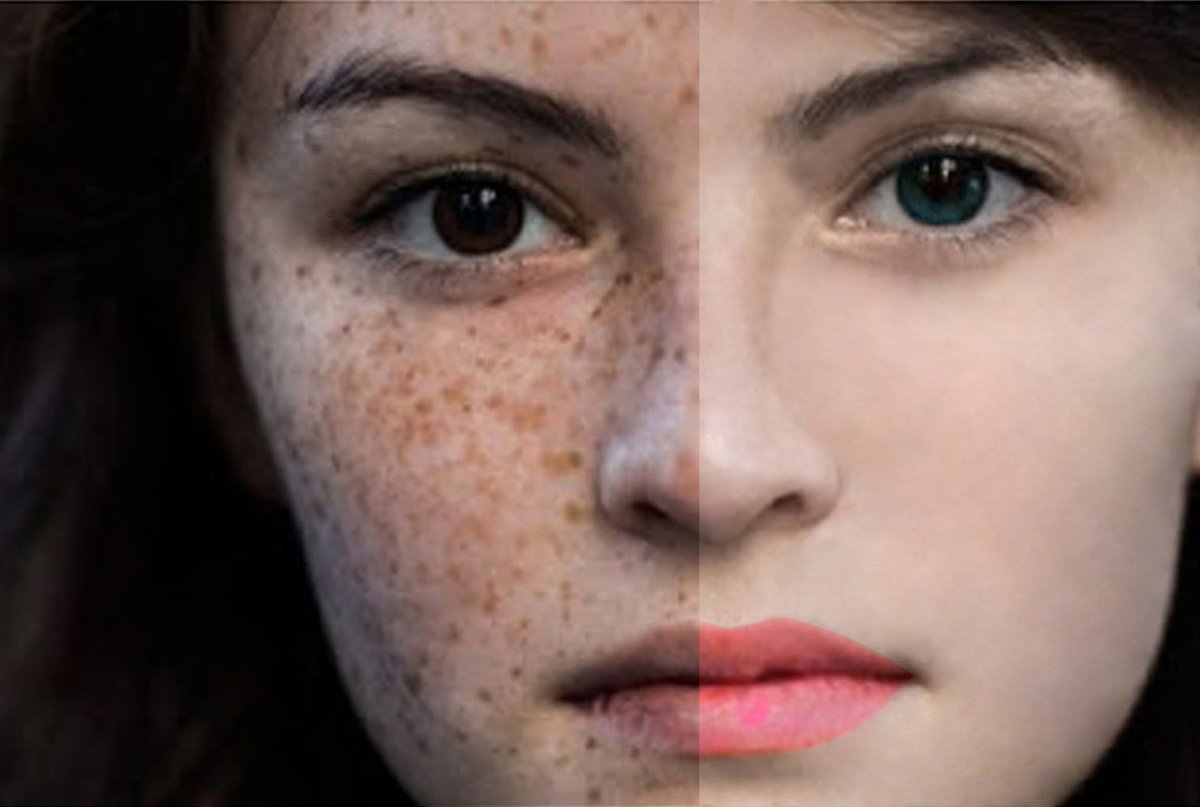 Defect face. Портрет с проблемной кожей. Defect face. Девушка с проблемной кожей. Портрет девушки с проблемной кожей.