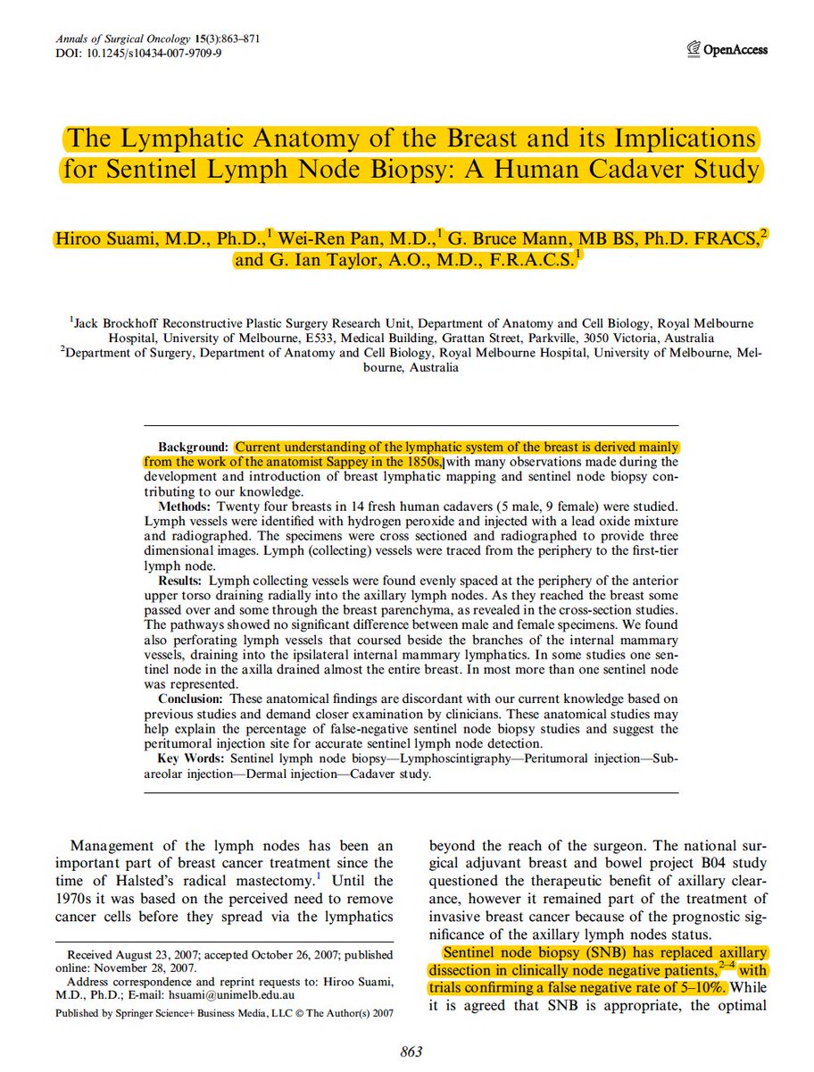 1LondonBreast's tweet photo. Where does your periareolar injection drain when mapping in #breastcancer? Our understanding of the #lymphatic system in the breast is based on work from 1850 (Sappey). Injection of #ICG using @StrykerPRS @StrykerEndo #SPYPHI. Time to rethink peritumoral injection? @JohnBoyages https://t.co/Oo6dF5AiGy