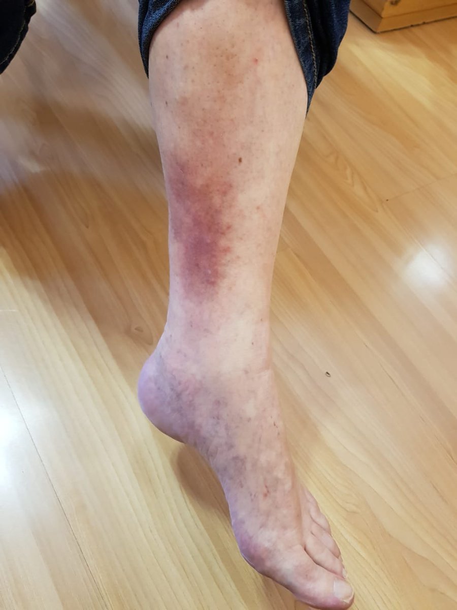 Acupuncture JHB (AcupunctureJhb) Twitter