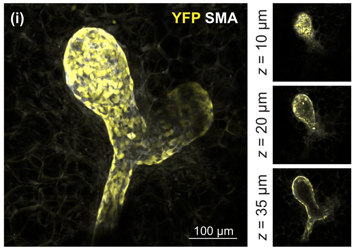 OliviaBH's tweet photo. Our new @MAD_Cambs publication with the wonderful @BethLloydLewis, @felicitydavis2 and @JessieJRH is out in @Dev_journal ! Looking at more #mammarystemcells with @CamPathology &amp; @SCICambridge https://t.co/2jPKTCS5cI https://t.co/TfRDQqFF6u