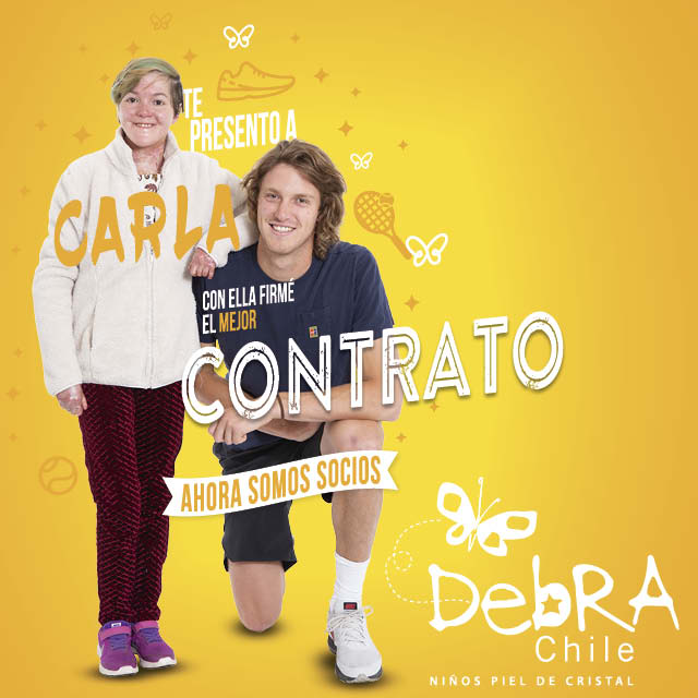 Así como <a href="/NicoJarry/">Nicolas Jarry Fillol</a>, tu también puedes convertirte en #SocioDebra y firmar el contrato de tu vida con nuestros niños y jóvenes en el siguiente link  bit.ly/2uiNcKo #DebraChile #POntetEnSuPiel