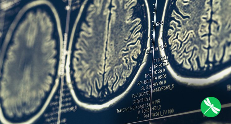 FDNtraining's tweet photo. Gut bacteria may offer clues into Multiple Sclerosis for sufferers. https://t.co/nOKm0I4kFl https://t.co/1HUmV4tZIi