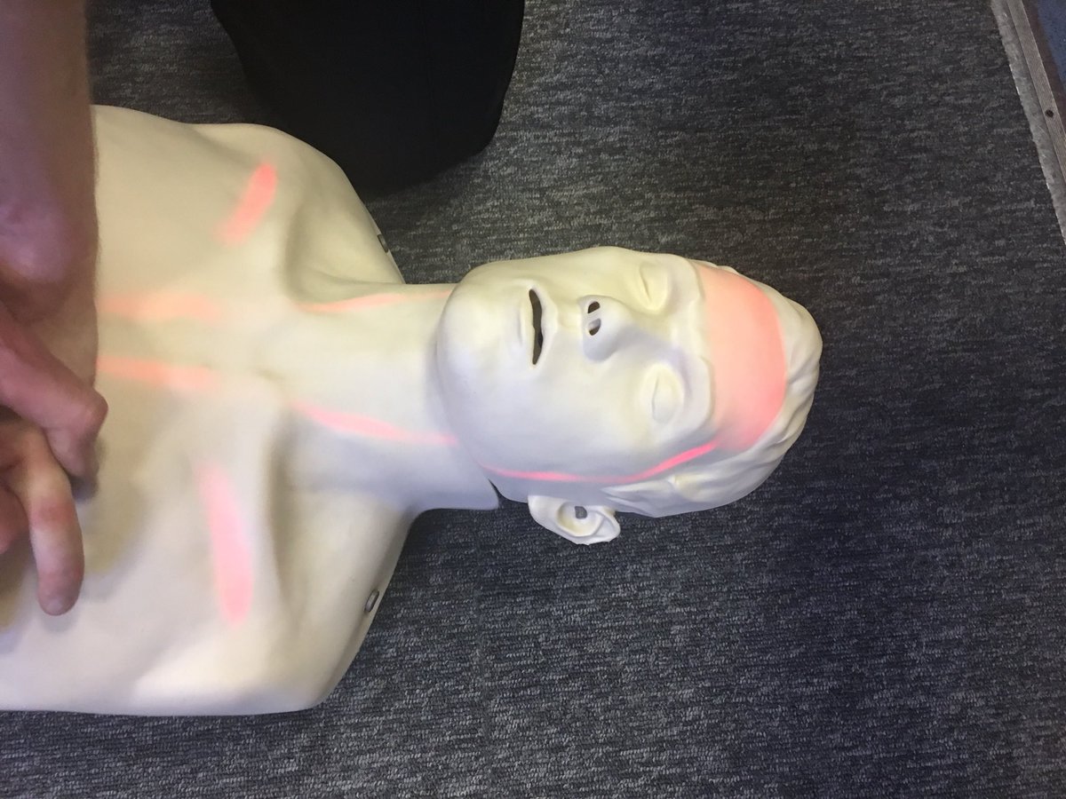 damo3633's tweet photo. Cas Care training this evening. New Brayden Innosonian CPR manikin progressively lights up as correct pressure &amp; compression rate is maintained. Definitely not as easy as I expected.... https://t.co/4VVvf632wH